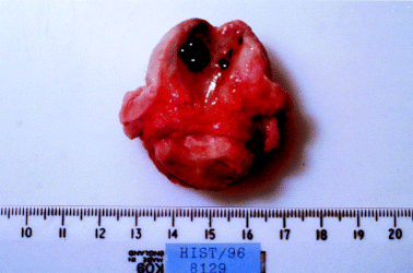 医学图像_生物组织样本_研究资料